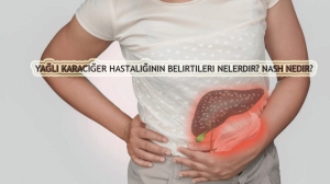 Yağlı karaciğer hastalığının belirtileri nelerdir? NASH nedir?